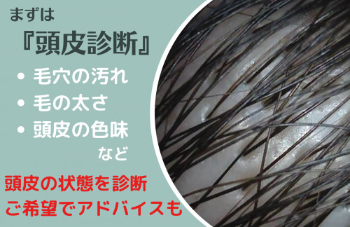 頭皮診断無料キャンペーン実施中!