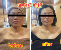 エステ