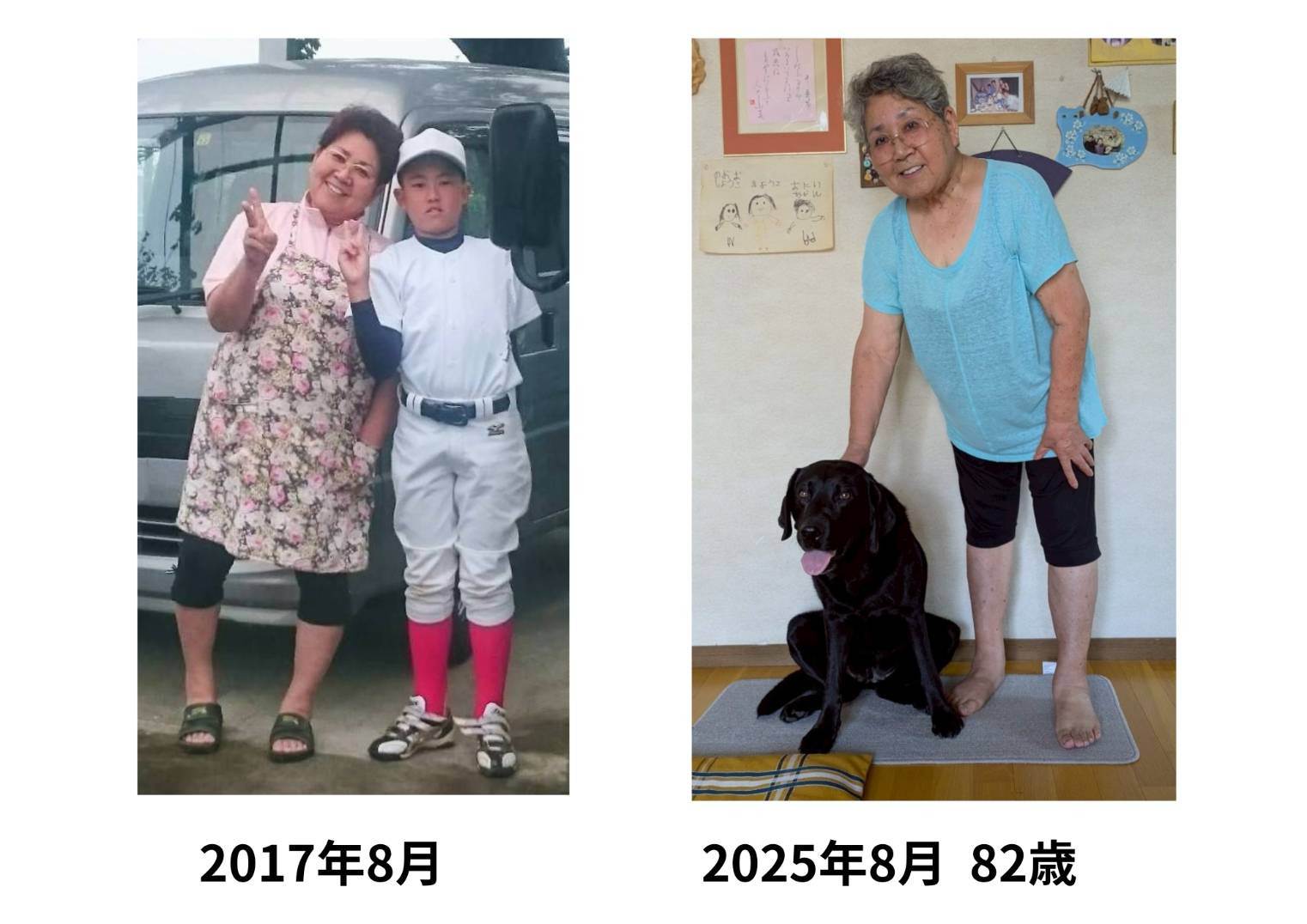 before and after