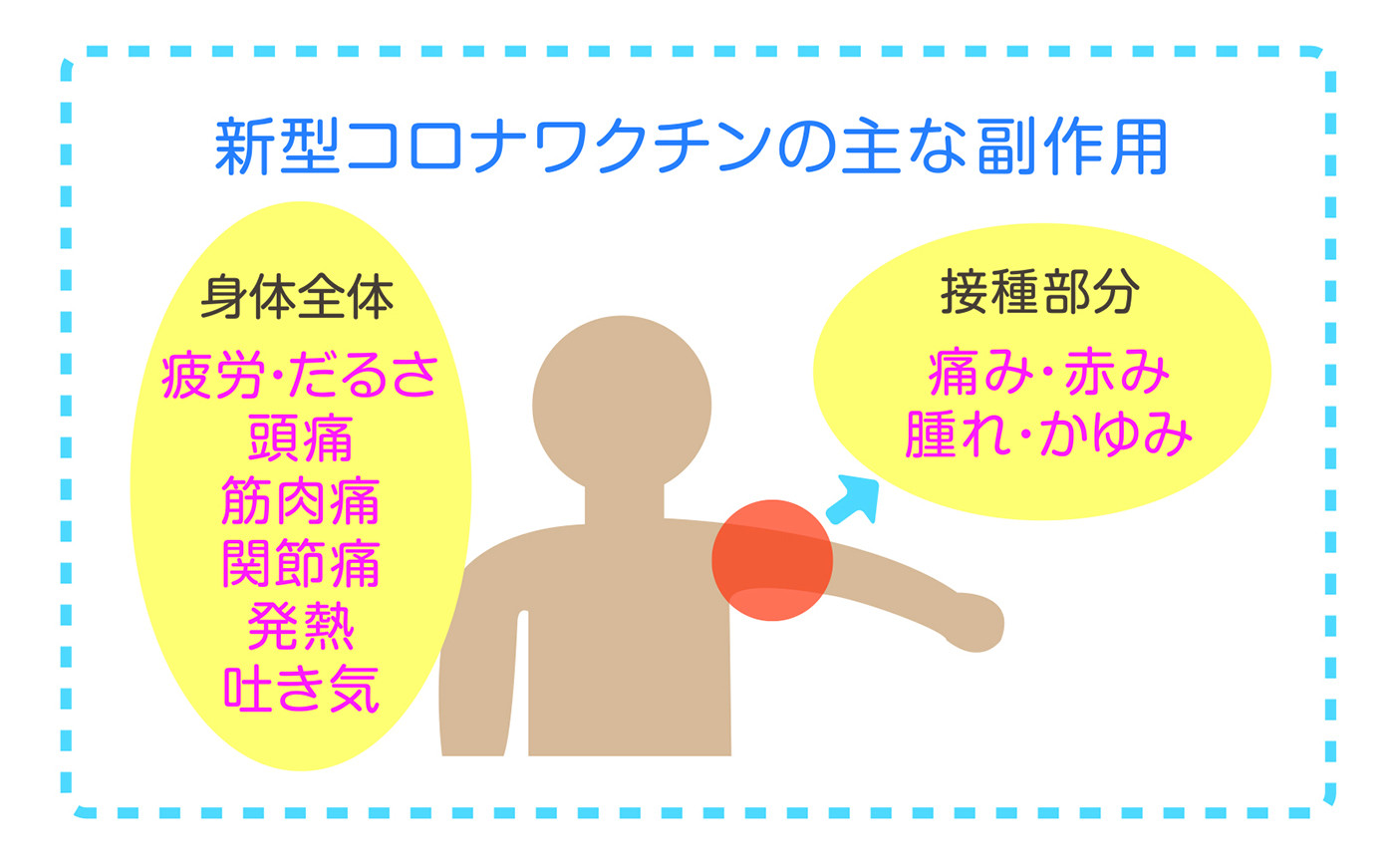 新型コロナワクチン副作用後の痛み治療