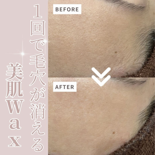 ⚜️スーパーフードWax⚜️。。。今話題の美肌になるWax脱毛