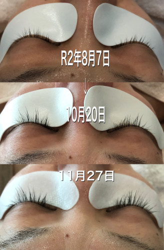 ビフォーアフター