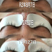 ビフォーアフター