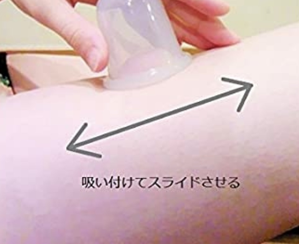【スライドカッピング】跡がつかない吸い玉カッピング