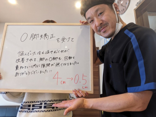 O脚モニター募集中!今だけお試し価格で美脚への第一歩を