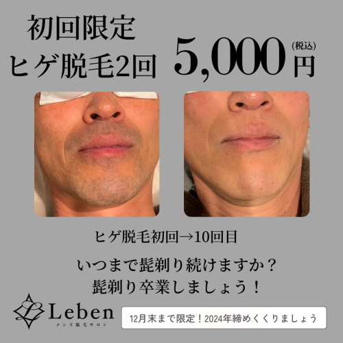 北九州のヒゲ脱毛🥸