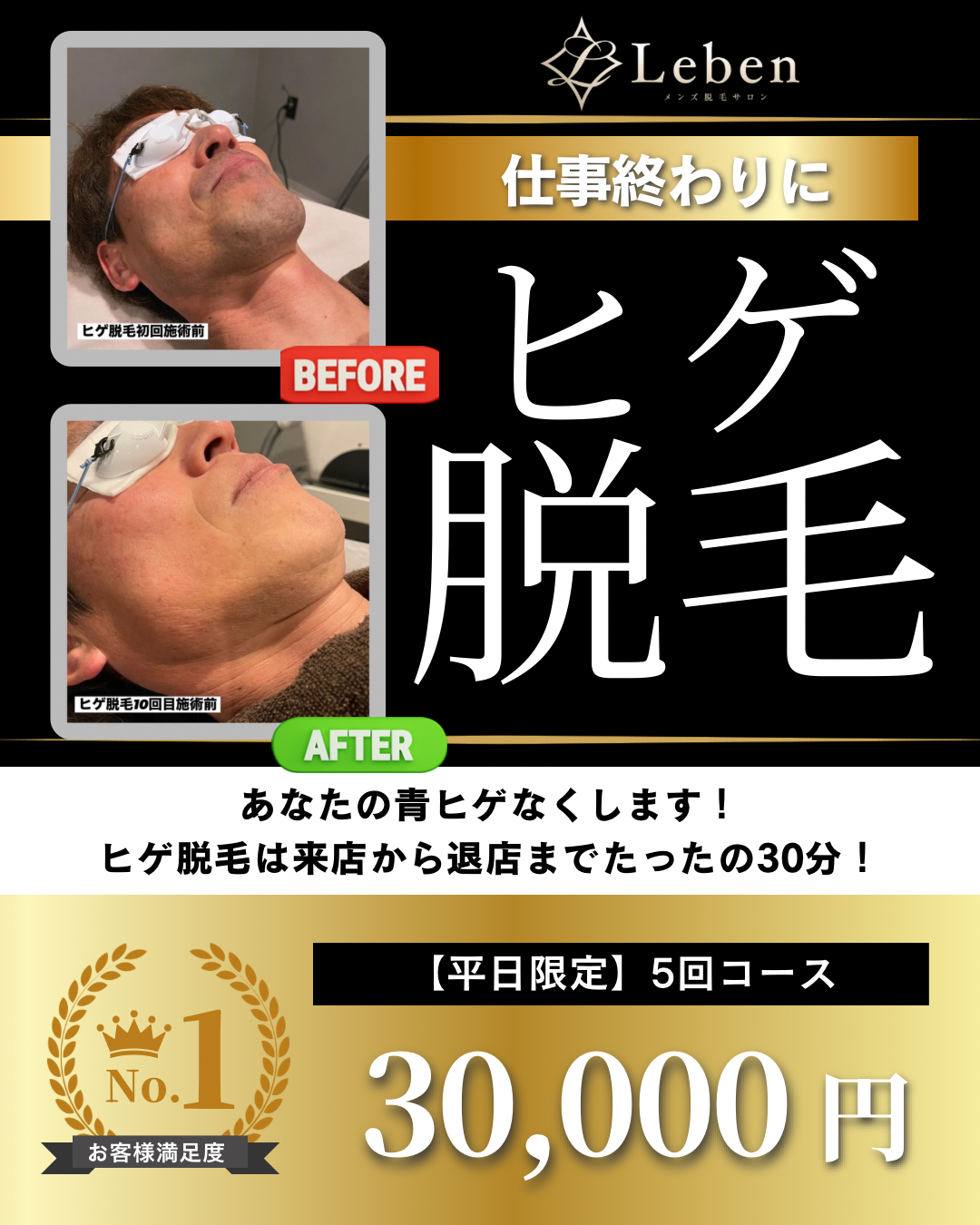 黒 白 金 モダン メンズ脱毛 Instagramの投稿.png