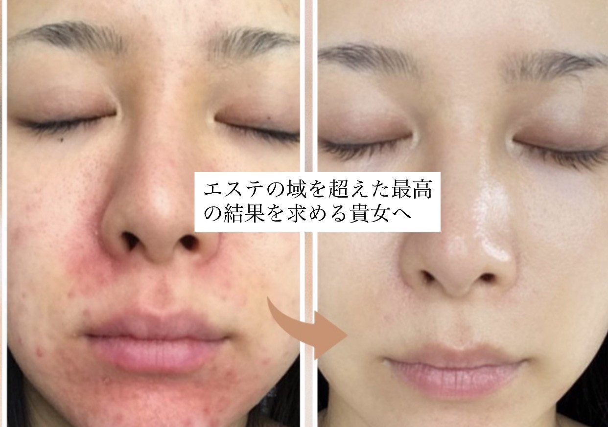 ホットペッパービューティーへ掲載