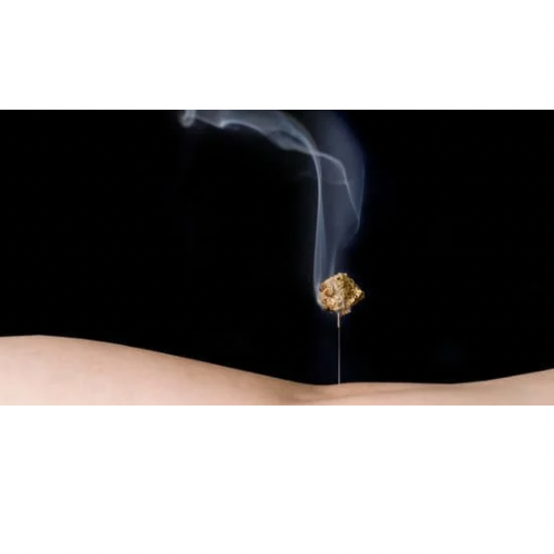 灸頭鍼