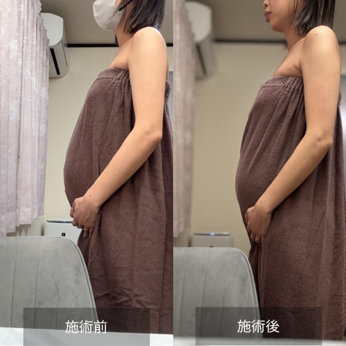 マタニティケア