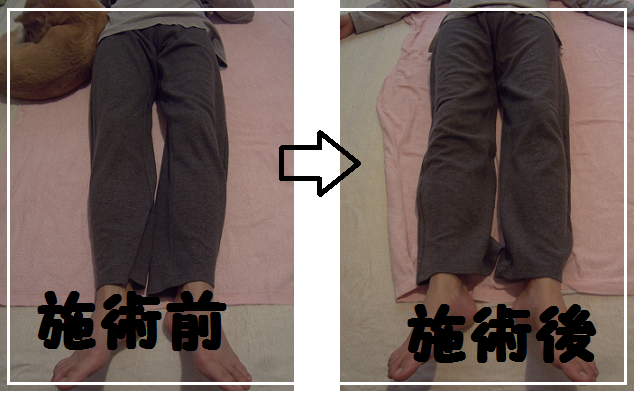 ビフォーアフター.png