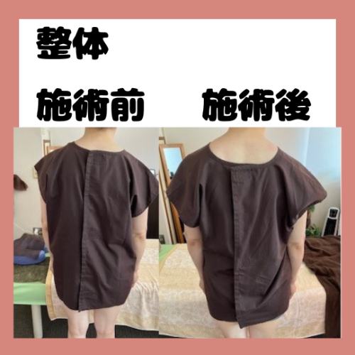 歪みも綺麗に整えます