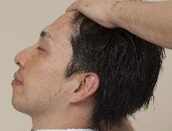 頭皮・頭髪のストレスはリンパドレナージュ併用でバッチリ！