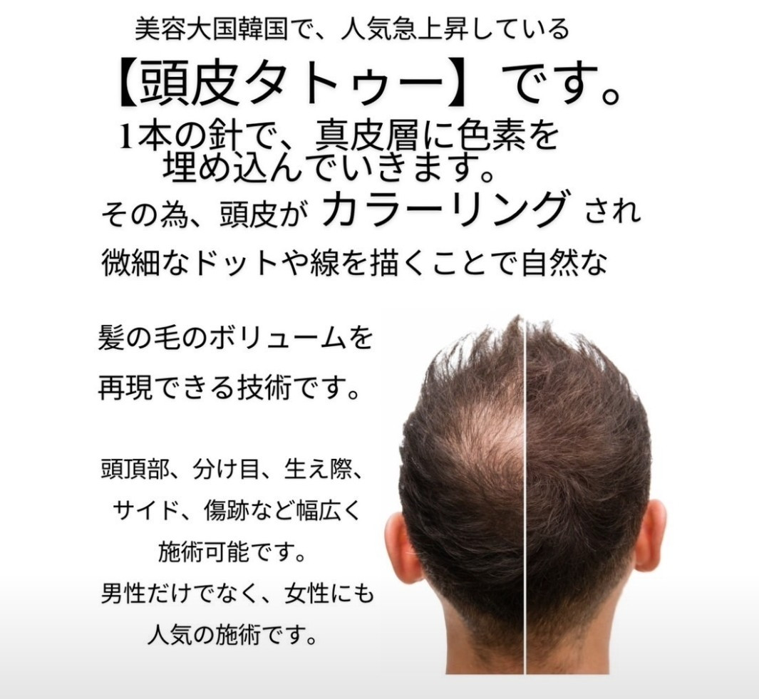 頭皮タトゥー