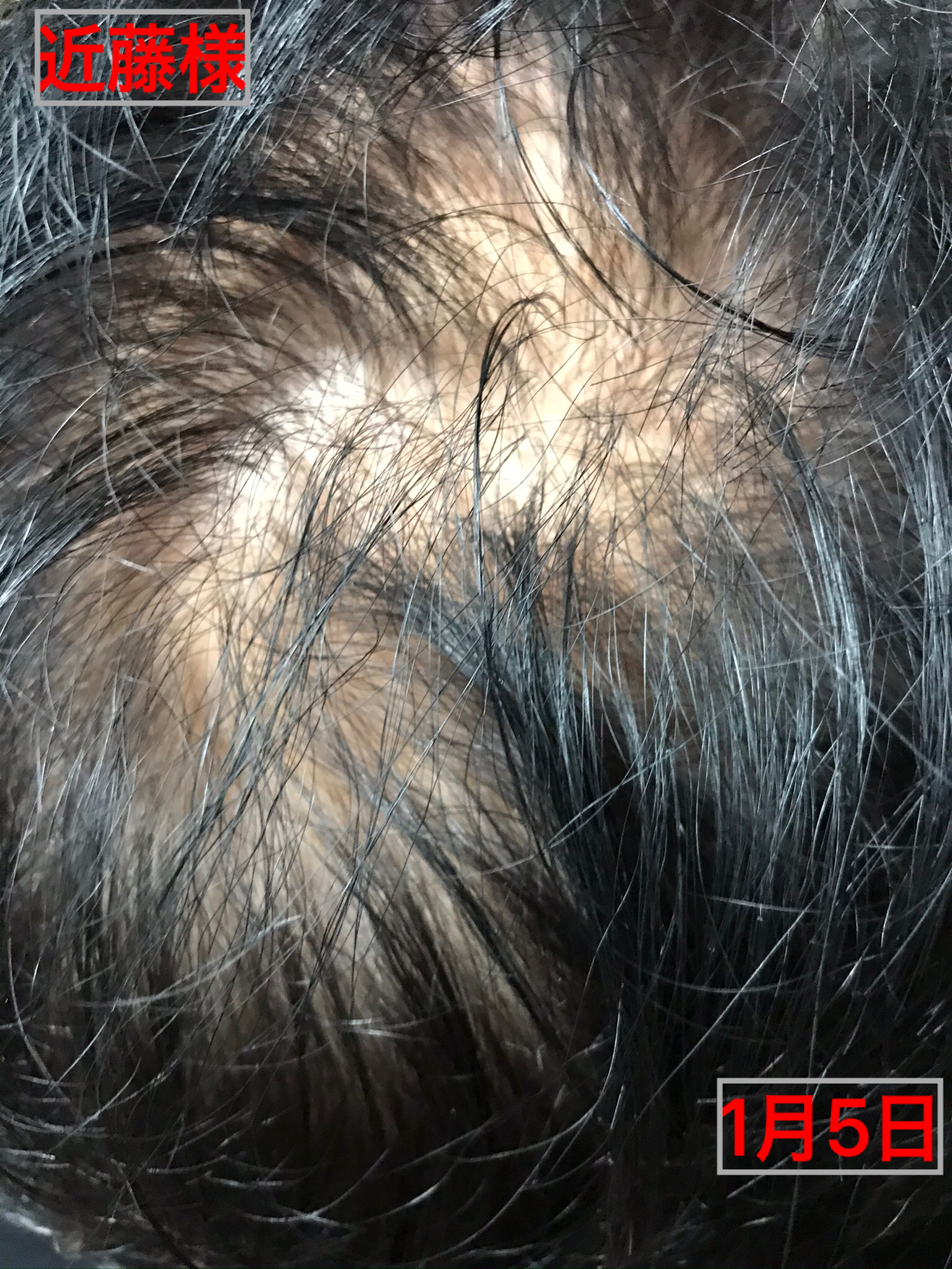 9E93EF56-6F07-4DF1-9C4F-5A76E616A086.png