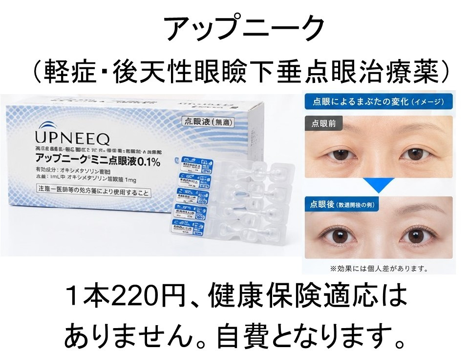 アップニーク