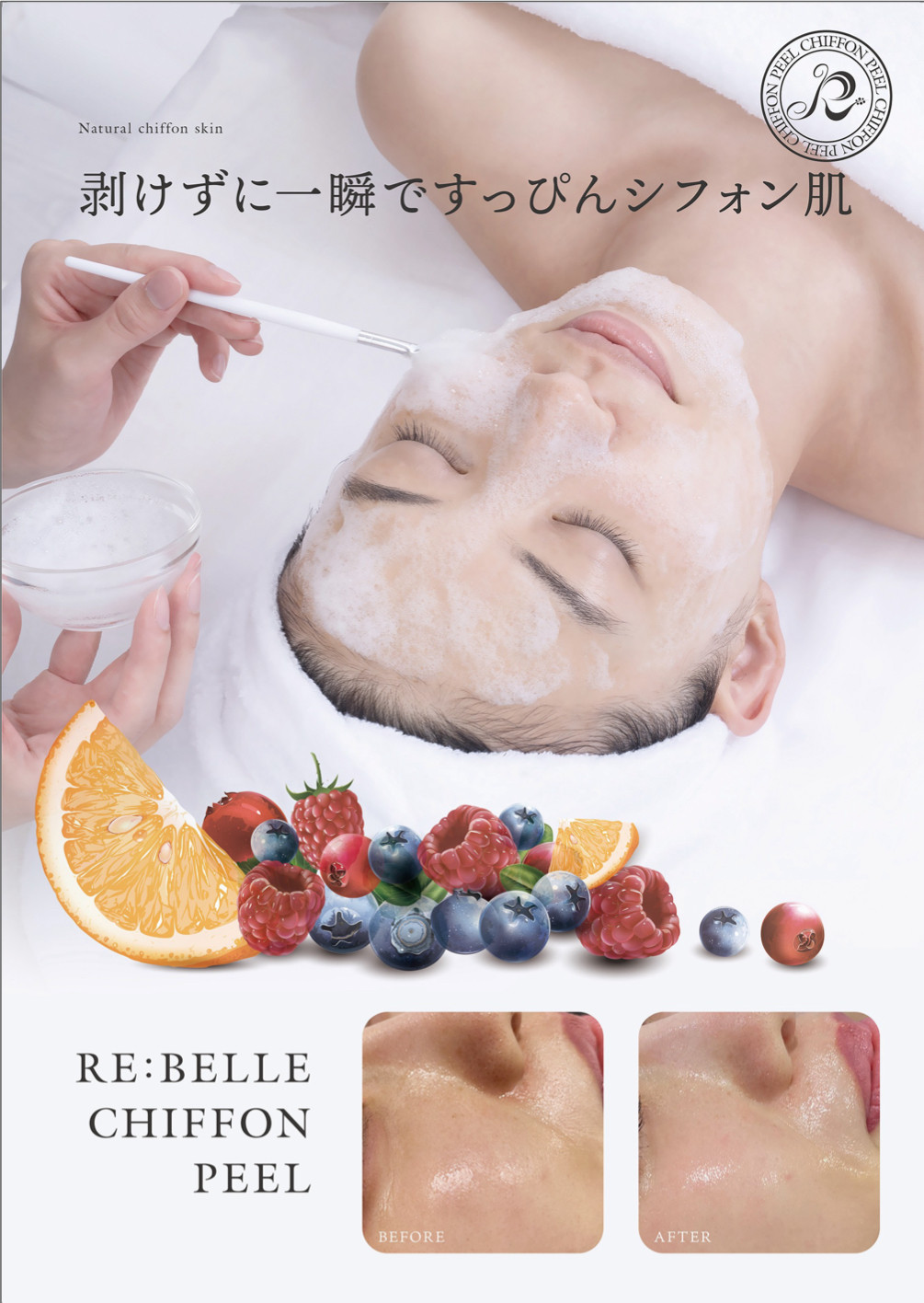 リベルシフォンピーリング+