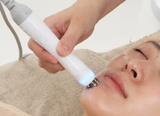 エレクトロポレーション