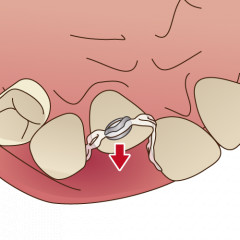 orthodontics041.png