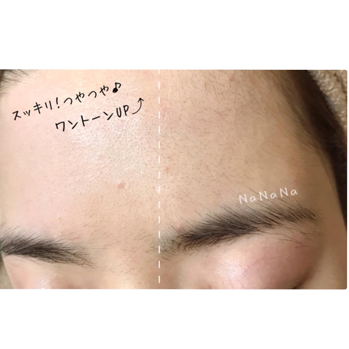 お顔全体のみ