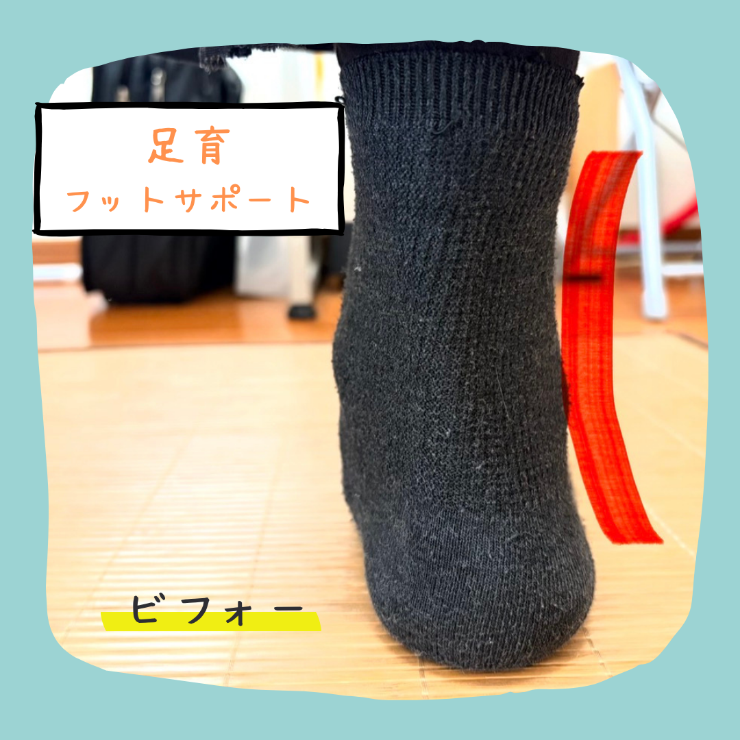 足育(フットサポート):before