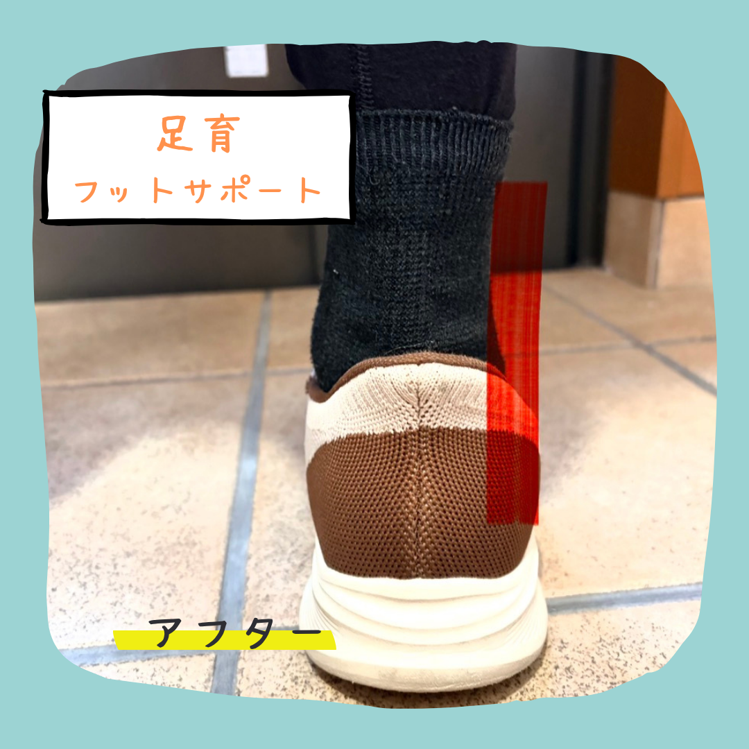 足育(フットサポート):after