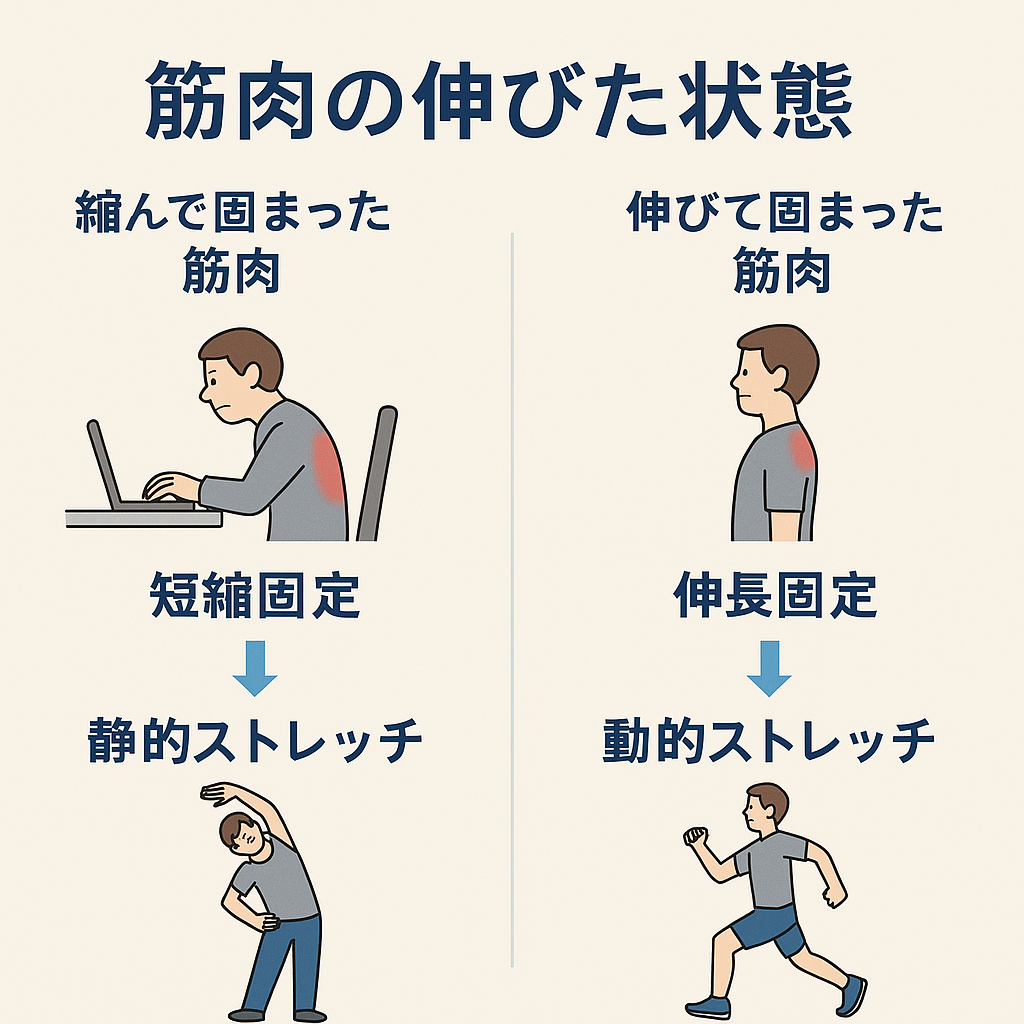 【伸びた筋肉も固まる?】ストレッチの誤解と効果的なアプローチ ※参考論文有り