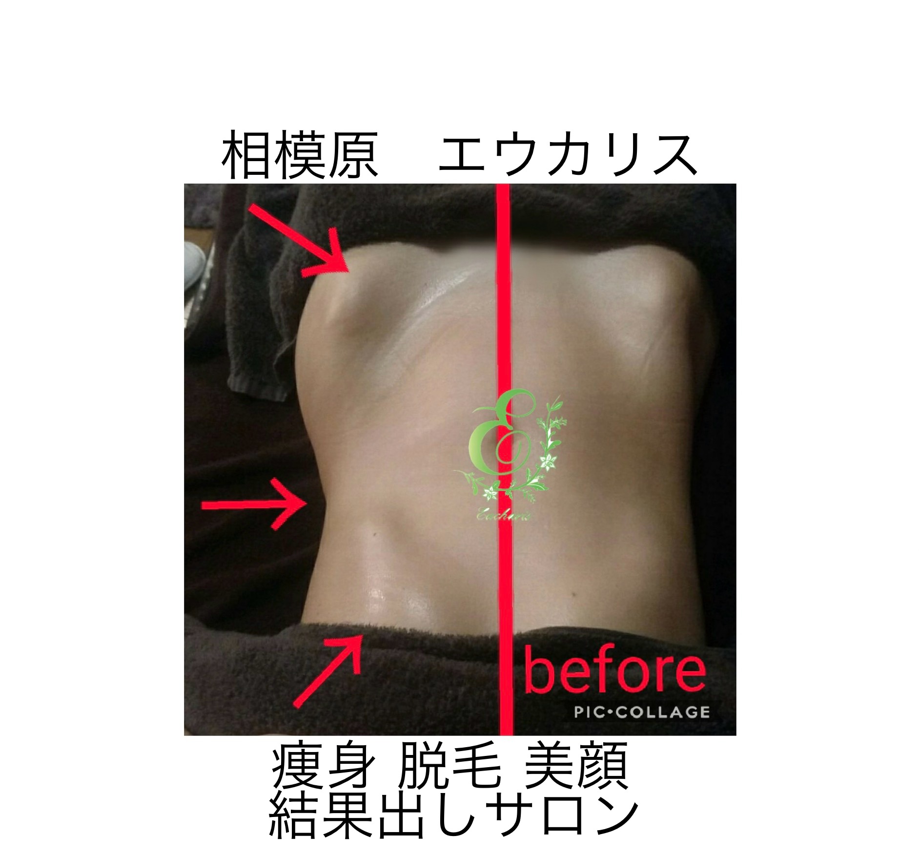 【周年記念キャンペーン】パワーレメディ全身