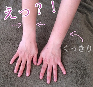 パラフィンパック続けたら、美白に?!