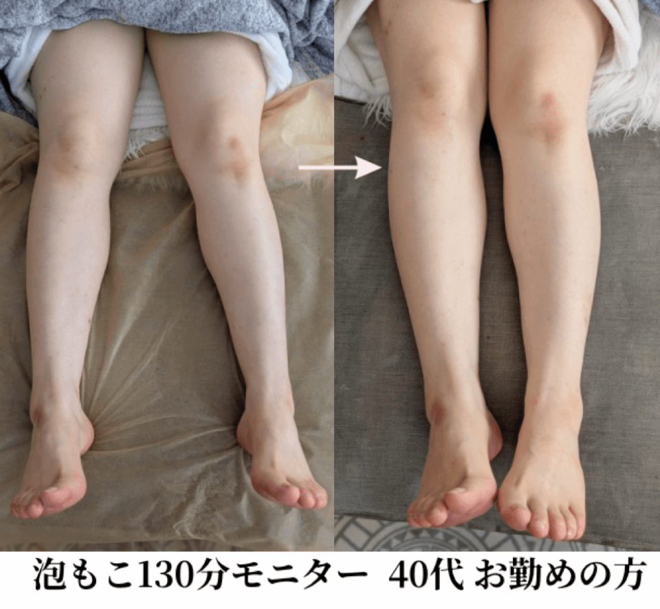 【泡もこ130分モニターご感想】全身が軽くなり、肌もしっとりスベスベになりました!