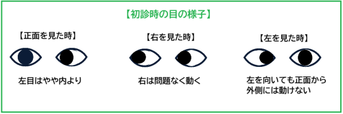 目の様子.png
