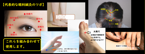 眼科鍼灸のツボ.png