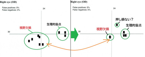 治療前治療後.jpg