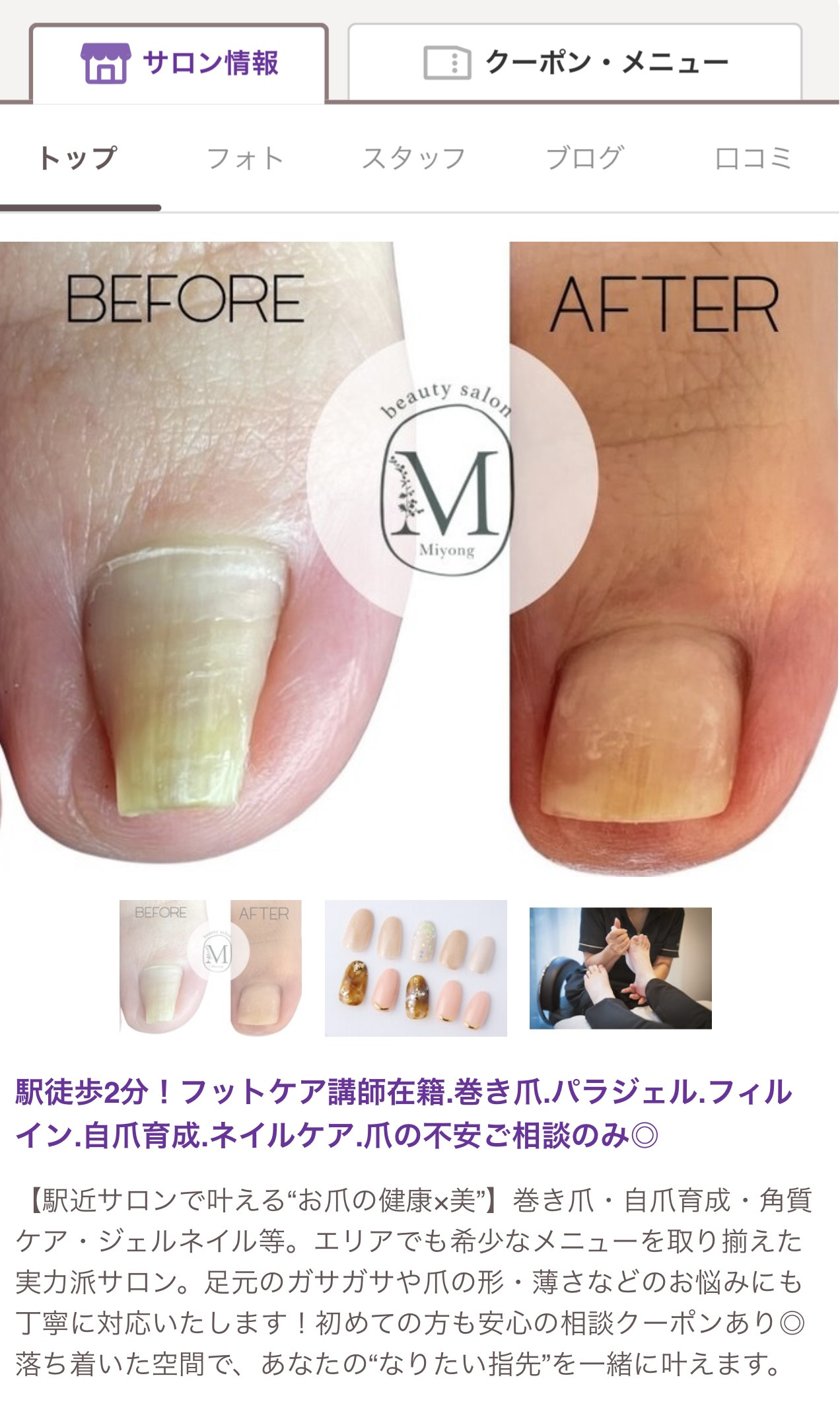 院内にネイルサロンオープン！