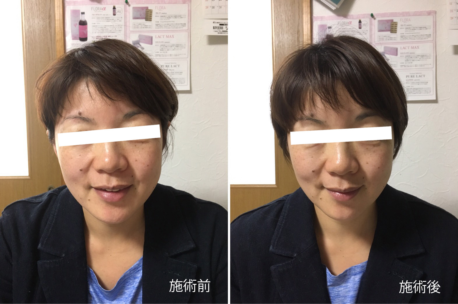 小顔美矯正コースの外観