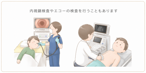 医師が内視鏡検査をするイラストとエコー検査をするイラスト。内視鏡やエコー検査を行う場合もあります