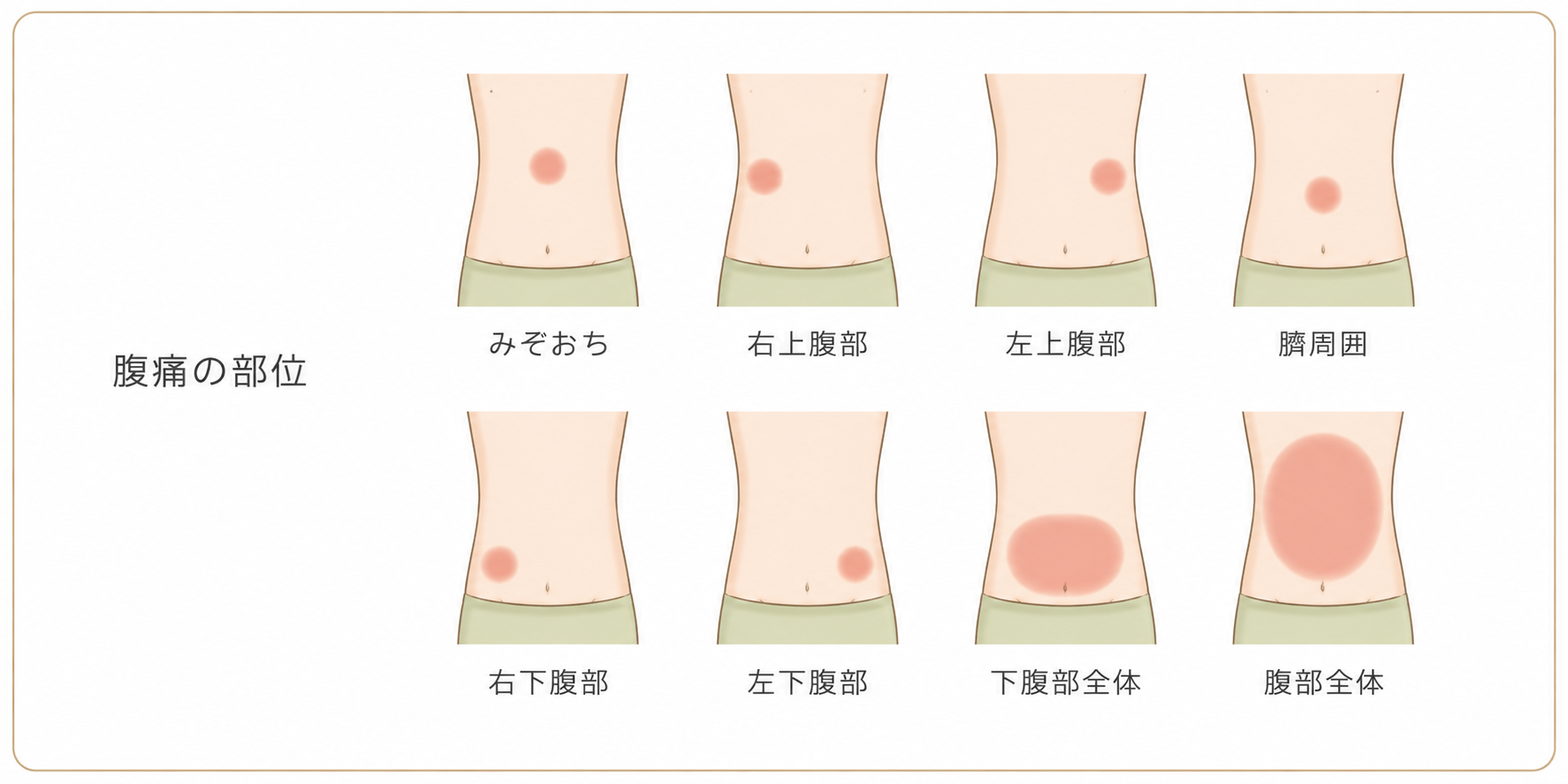 腹痛の部位別・考えられる原因疾患の図解