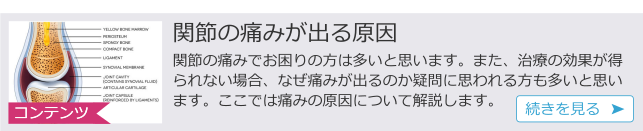 関節痛み.png