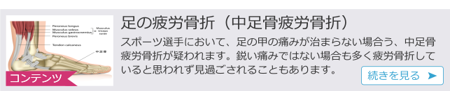 c 足の疲労骨折.png