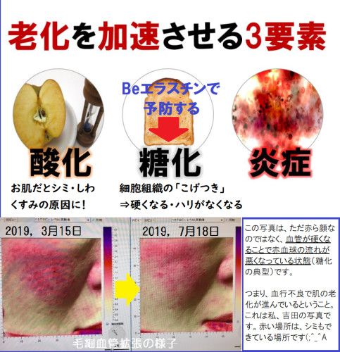 毛細血管の様子.png