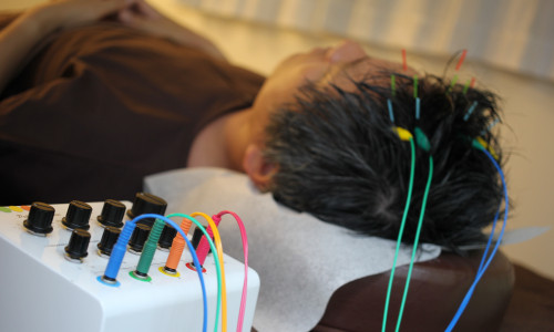 AGA治療イメージ