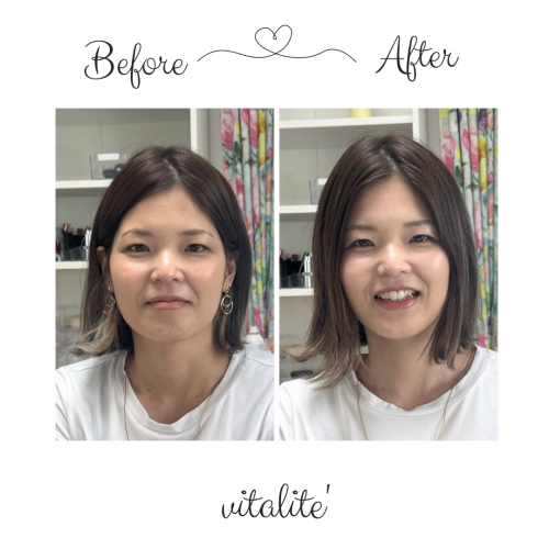Before.png
