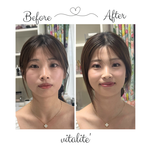 Before.png