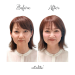 Before.png