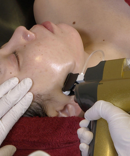 ACfacial.jpg