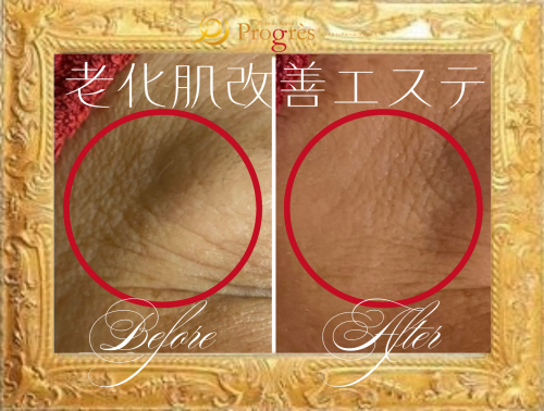 額文字あり.png