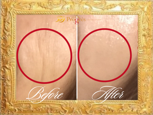 Before (1).png