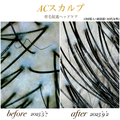 ACスカルプ　BA.jpg