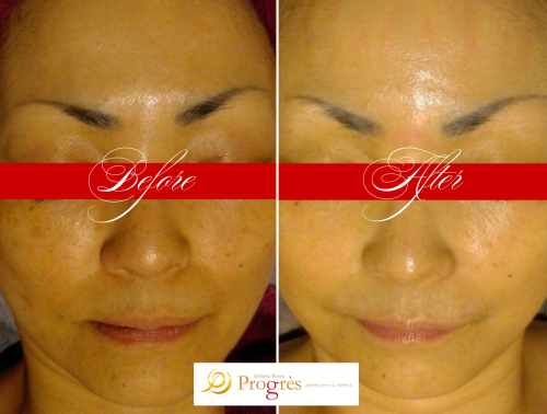 額あり掲載用作成画像23枚 (10).png