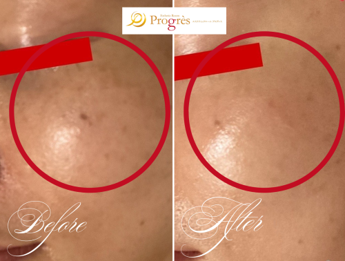 額あり掲載用作成画像23枚 (1).png